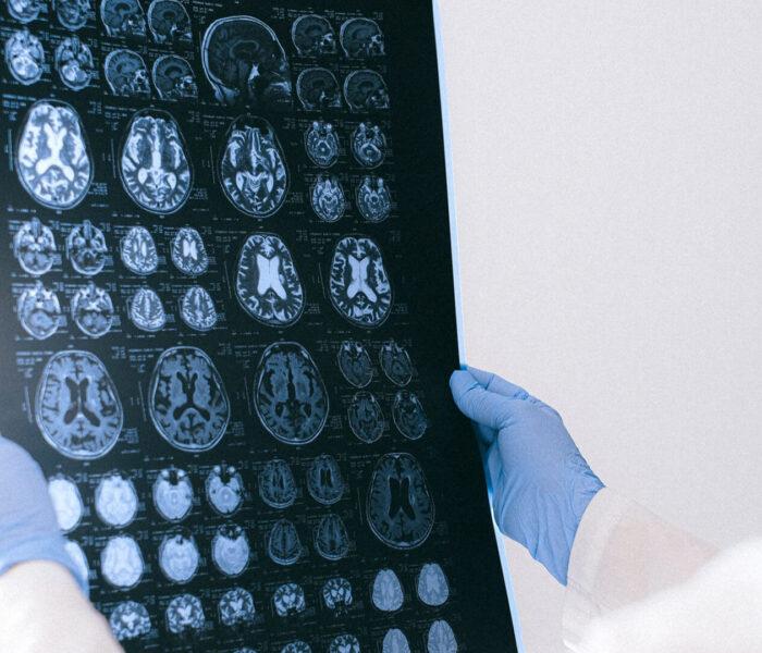 brain