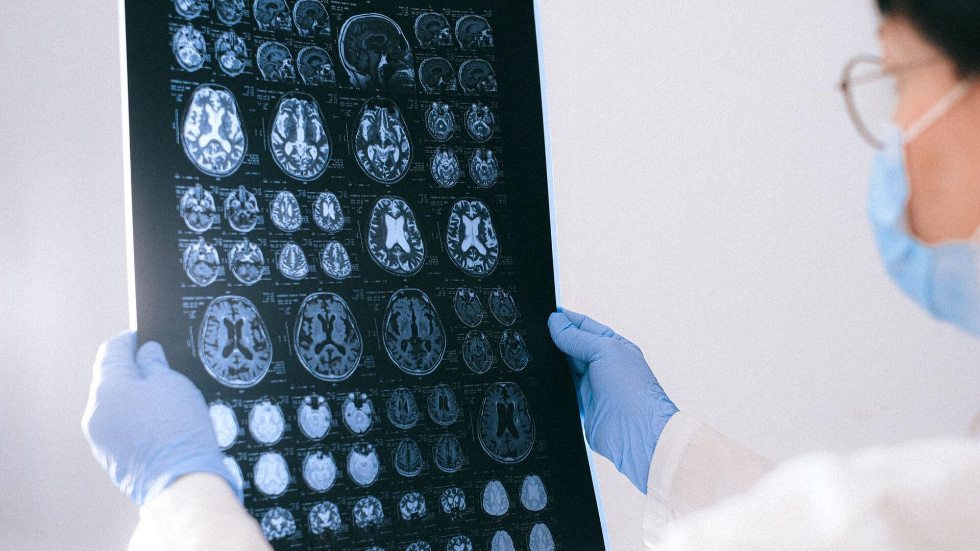 brain